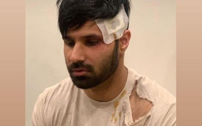 معروف یوٹیوبر رحیم پردیسی پر قاتلانہ حملہ