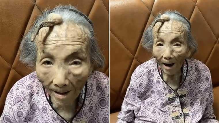 خاتون کے سر پر سینگ نکل آیا