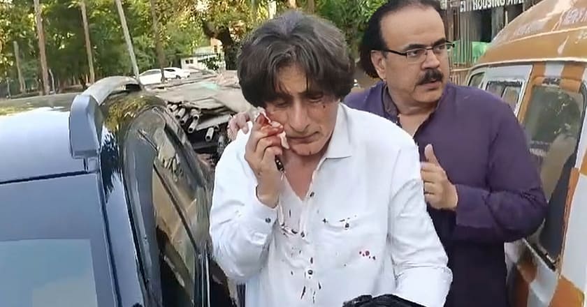 ترجمان پی ٹی آئی رؤف حسن پر بلیڈ سے حملہ، چہرہ زخمی