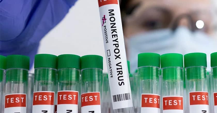 پاکستان میں منکی پاکس کا ایک اور کیس سامنے آگیا
